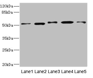 NFKBIE / IKB Epsilon Antibody - Western blot All Lanes: NFKBIE antibody at 4.17ug/ml Lane 1: Mouse liver tissue Lane 2: Hela whole cell lysate Lane 3: Jurkat whole cell lysate Lane 4: A375 whole cell lysate Lane 5: 293T whole cell lysate Secondary Goat polyclonal to rabbit IgG at 1/10000 dilution Predicted band size: 53 kDa Observed band size: 53 kDa