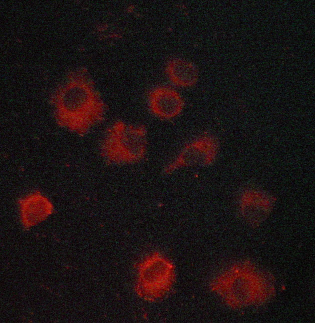NFKBIE / IKB Epsilon Antibody - Staining MCF-7 cells by IF/ICC. The samples were fixed with PFA and permeabilized in 0.1% saponin prior to blocking in 10% serum for 45 min at 37°C. The primary antibody was diluted 1/400 and incubated with the sample for 1 hour at 37°C. A Alexa Fluor® 594 conjugated goat polyclonal to rabbit IgG (H+L), diluted 1/600 was used as secondary antibody.
