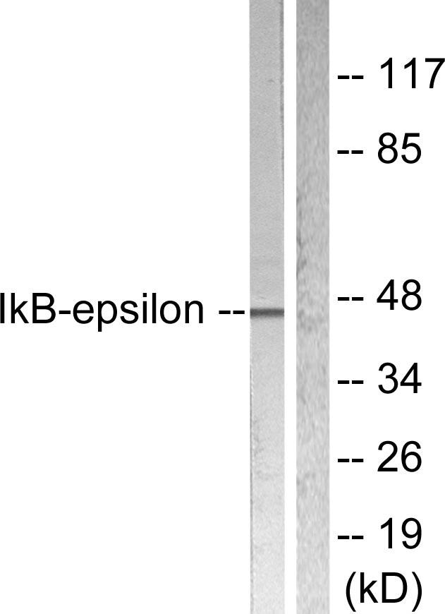 NFKBIE / IKB Epsilon Antibody - Western blot analysis of extracts from Hela cells treated with TNF-a (20ng/ml 5min), using I?B-e (Ab-22) antibody ( Line 1 and 2).