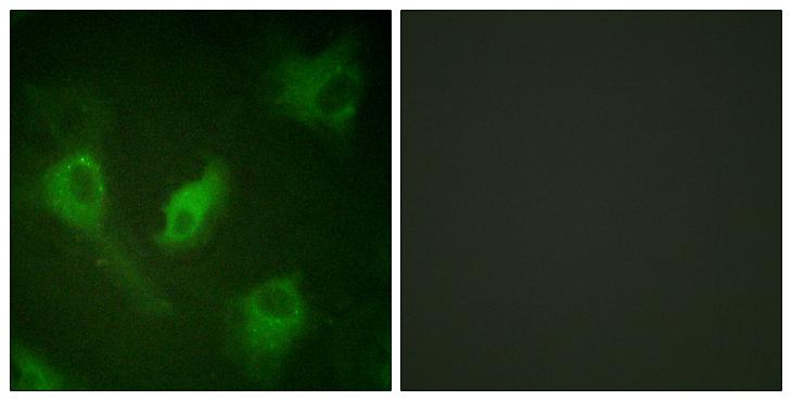 NFKBIE / IKB Epsilon Antibody - Peptide - + Immunofluorescence analysis of HeLa cells, using I?B-e (Ab-22) antibody.