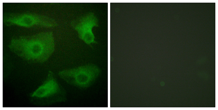 NFKBIE / IKB Epsilon Antibody - Immunofluorescence analysis of HeLa cells, using IkappaB-epsilon (Phospho-Ser22) Antibody. The picture on the right is blocked with the phospho peptide.