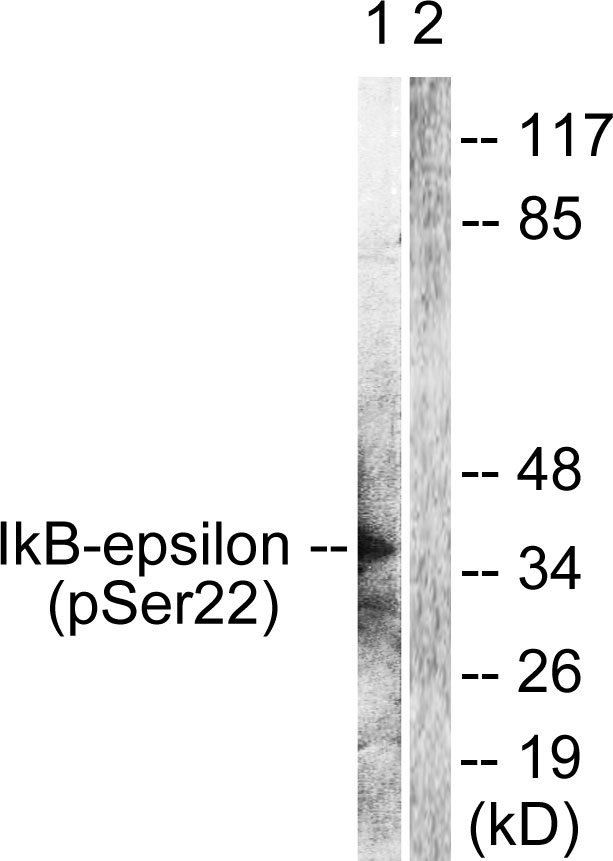 NFKBIE / IKB Epsilon Antibody - Western blot analysis of lysates from Jurkat cells treated with TNF-a 20ng/ml 30', using IkappaB-epsilon (Phospho-Ser22) Antibody. The lane on the right is blocked with the phospho peptide.