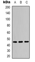 NFKBIE / IKB Epsilon Antibody - Western blot analysis of IKB epsilon (pS22) expression in HeLa LPS-treated (A); NIH3T3 LPS-treated (B); PC12 H2O2-treated (C) whole cell lysates.