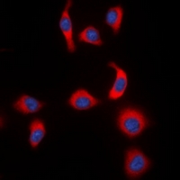 NFKBIE / IKB Epsilon Antibody - Immunofluorescent analysis of IKB epsilon (pS22) staining in HeLa cells. Formalin-fixed cells were permeabilized with 0.1% Triton X-100 in TBS for 5-10 minutes and blocked with 3% BSA-PBS for 30 minutes at room temperature. Cells were probed with the primary antibody in 3% BSA-PBS and incubated overnight at 4 deg C in a humidified chamber. Cells were washed with PBST and incubated with a DyLight 594-conjugated secondary antibody (red) in PBS at room temperature in the dark. DAPI was used to stain the cell nuclei (blue).