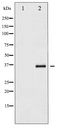 NFKBIE / IKB Epsilon Antibody - Western blot of I kappaB- epsilon phosphorylation expression in TNF-a treated Jurkat whole cell lysates,The lane on the left is treated with the antigen-specific peptide.