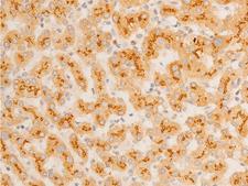 NFKBIE / IKB Epsilon Antibody - 1:100 staining human liver tissue by IHC-P. The tissue was formaldehyde fixed and a heat mediated antigen retrieval step in citrate buffer was performed. The tissue was then blocked and incubated with the antibody for 1.5 hours at 22°C. An HRP conjugated goat anti-rabbit antibody was used as the secondary.