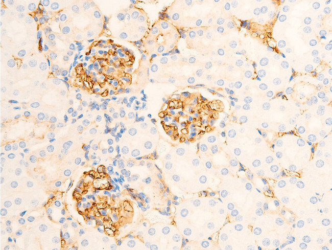 NFKBIE / IKB Epsilon Antibody - 1:100 staining mouse kidney tissue by IHC-P. The tissue was formaldehyde fixed and a heat mediated antigen retrieval step in citrate buffer was performed. The tissue was then blocked and incubated with the antibody for 1.5 hours at 22°C. An HRP conjugated goat anti-rabbit antibody was used as the secondary.