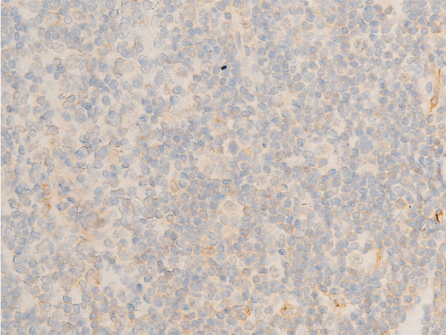 NFKBIE / IKB Epsilon Antibody - 1:100 staining human appendix tissue by IHC-P. The tissue was formaldehyde fixed and a heat mediated antigen retrieval step in citrate buffer was performed. The tissue was then blocked and incubated with the antibody for 1.5 hours at 22°C. An HRP conjugated goat anti-rabbit antibody was used as the secondary.