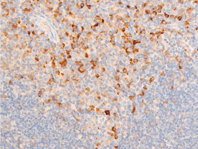 NFKBIE / IKB Epsilon Antibody - 1:100 staining mouse spleen tissue by IHC-P. The tissue was formaldehyde fixed and a heat mediated antigen retrieval step in citrate buffer was performed. The tissue was then blocked and incubated with the antibody for 1.5 hours at 22°C. An HRP conjugated goat anti-rabbit antibody was used as the secondary.
