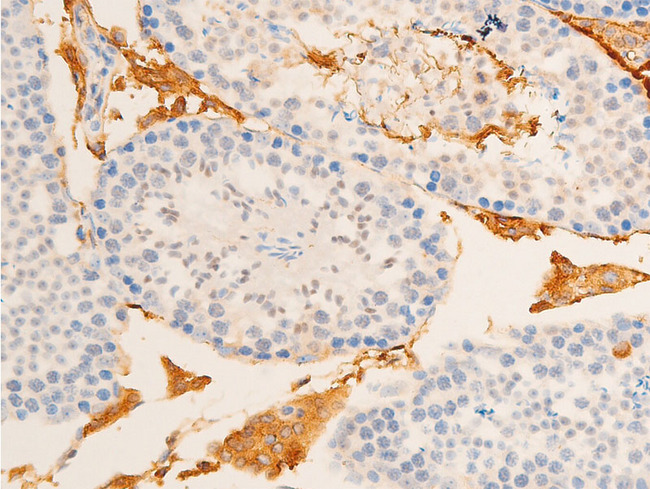 NFKBIE / IKB Epsilon Antibody - 1:100 staining mouse testis tissue by IHC-P. The tissue was formaldehyde fixed and a heat mediated antigen retrieval step in citrate buffer was performed. The tissue was then blocked and incubated with the antibody for 1.5 hours at 22°C. An HRP conjugated goat anti-rabbit antibody was used as the secondary.