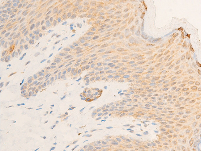 NFKBIE / IKB Epsilon Antibody - 1:100 staining human skin tissue by IHC-P. The tissue was formaldehyde fixed and a heat mediated antigen retrieval step in citrate buffer was performed. The tissue was then blocked and incubated with the antibody for 1.5 hours at 22°C. An HRP conjugated goat anti-rabbit antibody was used as the secondary.