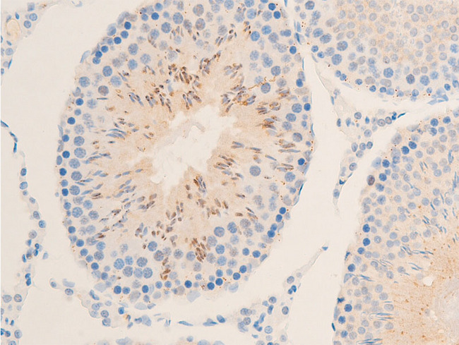 NFKBIE / IKB Epsilon Antibody - 1:100 staining rat testis tissue by IHC-P. The tissue was formaldehyde fixed and a heat mediated antigen retrieval step in citrate buffer was performed. The tissue was then blocked and incubated with the antibody for 1.5 hours at 22°C. An HRP conjugated goat anti-rabbit antibody was used as the secondary.