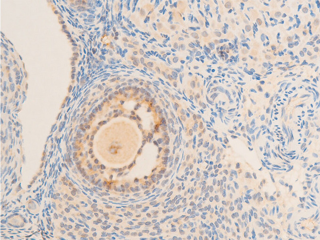 NFKBIE / IKB Epsilon Antibody - 1:100 staining rat ovarian tissue by IHC-P. The tissue was formaldehyde fixed and a heat mediated antigen retrieval step in citrate buffer was performed. The tissue was then blocked and incubated with the antibody for 1.5 hours at 22°C. An HRP conjugated goat anti-rabbit antibody was used as the secondary.