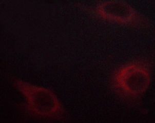 NFKBIE / IKB Epsilon Antibody - Staining HeLa cells by IF/ICC. The samples were fixed with PFA and permeabilized in 0.1% saponin prior to blocking in 10% serum for 45 min at 37°C. The primary antibody was diluted 1/400 and incubated with the sample for 1 hour at 37°C. A Alexa Fluor® 594 conjugated goat polyclonal to rabbit IgG (H+L), diluted 1/600 was used as secondary antibody.