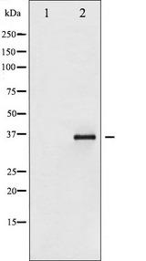 NFKBIE / IKB Epsilon Antibody - Western blot analysis of IkappaB-epsilon phosphorylation expression in TNF-a treated Jurkat whole cells lysates. The lane on the left is treated with the antigen-specific peptide.