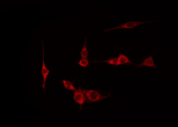 NFKBIE / IKB Epsilon Antibody - Staining HeLa cells by IF/ICC. The samples were fixed with PFA and permeabilized in 0.1% Triton X-100, then blocked in 10% serum for 45 min at 25°C. The primary antibody was diluted at 1:200 and incubated with the sample for 1 hour at 37°C. An Alexa Fluor 594 conjugated goat anti-rabbit IgG (H+L) Ab, diluted at 1/600, was used as the secondary antibody.