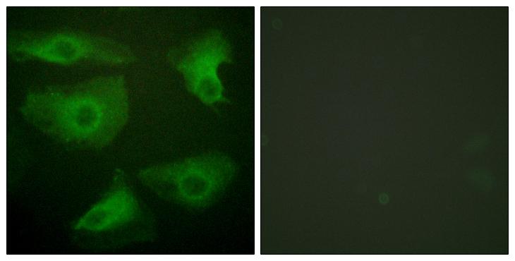 NFKBIE / IKB Epsilon Antibody - P-peptide - + Immunofluorescence analysis of HeLa cells, using I?B-e (phospho-Ser22) antibody.