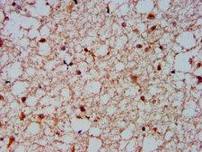 NFKBIL1 Antibody - Immunohistochemistry Dilution at 1:600 and staining in paraffin-embedded human brain tissue performed on a Leica BondTM system. After dewaxing and hydration, antigen retrieval was mediated by high pressure in a citrate buffer (pH 6.0). Section was blocked with 10% normal Goat serum 30min at RT. Then primary antibody (1% BSA) was incubated at 4°C overnight. The primary is detected by a biotinylated Secondary antibody and visualized using an HRP conjugated SP system.
