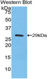 NFKBIZ / IKBZ Antibody - Western blot of recombinant NFKBIZ / IKBZ.  This image was taken for the unconjugated form of this product. Other forms have not been tested.