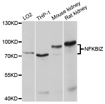 NFKBIZ / IKBZ Antibody - Western blot analysis of extracts of various cell lines, using NFKBIZ antibody at 1:1000 dilution. The secondary antibody used was an HRP Goat Anti-Rabbit IgG (H+L) at 1:10000 dilution. Lysates were loaded 25ug per lane and 3% nonfat dry milk in TBST was used for blocking. An ECL Kit was used for detection and the exposure time was 10s.