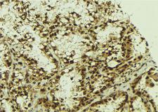 NFKBIZ / IKBZ Antibody - 1:100 staining human lung tissue by IHC-P. The sample was formaldehyde fixed and a heat mediated antigen retrieval step in citrate buffer was performed. The sample was then blocked and incubated with the antibody for 1.5 hours at 22°C. An HRP conjugated goat anti-rabbit antibody was used as the secondary.