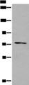 NFKBIZ / IKBZ Antibody - Western blot analysis of 293T cell lysate  using NFKBIZ Polyclonal Antibody at dilution of 1:500