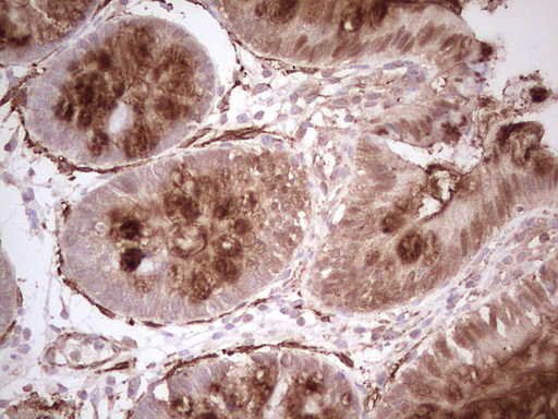 NFS1 Antibody - Immunohistochemical staining of paraffin-embedded Human colon tissue within the normal limits using anti-NFS1 mouse monoclonal antibody. (Heat-induced epitope retrieval by 1 mM EDTA in 10mM Tris, pH8.5, 120C for 3min,