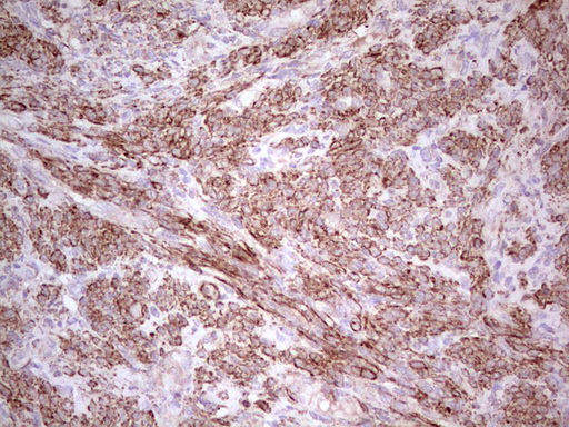 NFS1 Antibody - IHC of paraffin-embedded Human endometrium tissue using anti-NFS1 mouse monoclonal antibody. (Heat-induced epitope retrieval by 1 mM EDTA in 10mM Tris, pH8.5, 120°C for 3min).