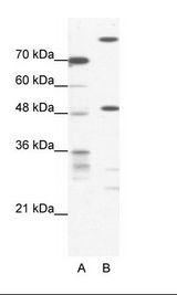 NFS1 Antibody - A: Marker, B: HepG2 Cell Lysate.  This image was taken for the unconjugated form of this product. Other forms have not been tested.