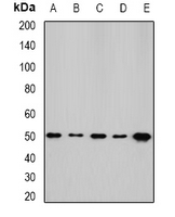 NFS1 Antibody - Western blot analysis of NFS1 expression in HepG2 (A); SKOV3 (B); mouse kidney (C); mouse heart (D); rat liver (E) whole cell lysates.