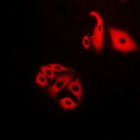 NFS1 Antibody - Immunofluorescent analysis of NFS1 staining in HeLa cells. Formalin-fixed cells were permeabilized with 0.1% Triton X-100 in TBS for 5-10 minutes and blocked with 3% BSA-PBS for 30 minutes at room temperature. Cells were probed with the primary antibody in 3% BSA-PBS and incubated overnight at 4 deg C in a humidified chamber. Cells were washed with PBST and incubated with a DyLight 594-conjugated secondary antibody (red) in PBS at room temperature in the dark.