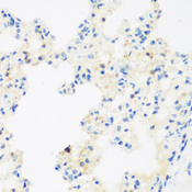 NFU1 Antibody - Immunohistochemistry of paraffin-embedded rat lung tissue.