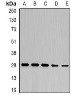 NFU1 Antibody - Western blot analysis of NFU1 expression in SW480 (A); mouse liver (B); mouse heart (C); rat liver (D); rat heart (E) whole cell lysates.
