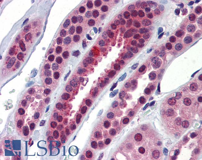 NFX1 Antibody - Anti-NFX1 antibody IHC of human kidney. Immunohistochemistry of formalin-fixed, paraffin-embedded tissue after heat-induced antigen retrieval. Antibody concentration 5 ug/ml.  This image was taken for the unconjugated form of this product. Other forms have not been tested.