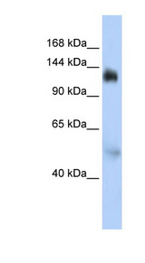 NFX1 Antibody - NFX1 antibody Western blot of HepG2 cell lysate. This image was taken for the unconjugated form of this product. Other forms have not been tested.