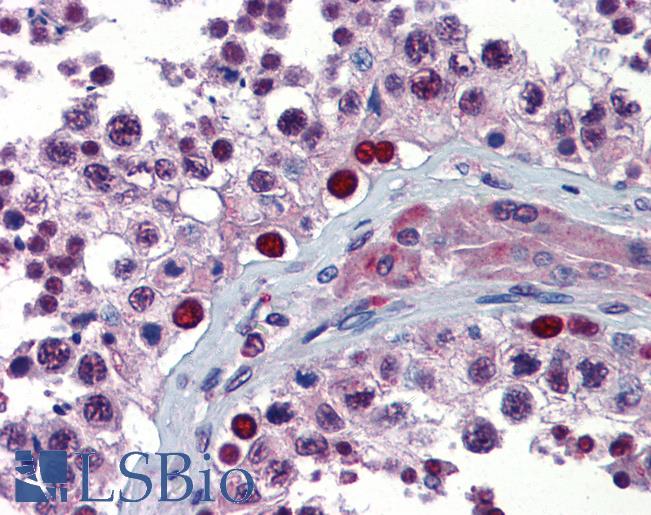 NFX1 Antibody - Anti-NFX1 antibody IHC of human testis. Immunohistochemistry of formalin-fixed, paraffin-embedded tissue after heat-induced antigen retrieval. Antibody concentration 5 ug/ml.  This image was taken for the unconjugated form of this product. Other forms have not been tested.