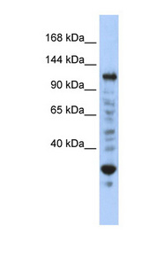 NFX1 Antibody - NFX1 antibody Western blot of Jurkat lysate. This image was taken for the unconjugated form of this product. Other forms have not been tested.