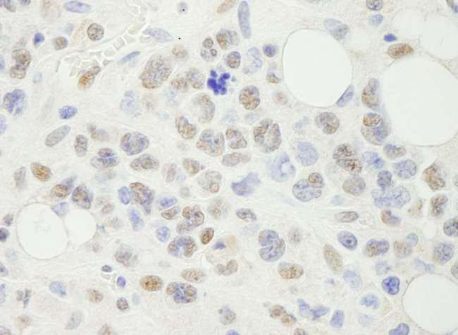 NFYA Antibody - Detection of Mouse NF-YA by Immunohistochemistry. Sample: FFPE section of mouse hybridoma tumor. Antibody: Affinity purified rabbit anti-NF-YA used at a dilution of 1:250.