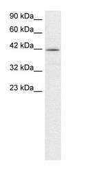 NFYA Antibody - Jurkat Cell Lysate.  This image was taken for the unconjugated form of this product. Other forms have not been tested.