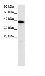 NFYA Antibody - Jurkat Cell Lysate.  This image was taken for the unconjugated form of this product. Other forms have not been tested.