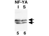 NFYA Antibody - Anti-NF-Y(A subunit) Antibody - Western Blot. CHO-7 cells were cultured in the absence (I) or presence (S) of cholesterol. Equivalent aliquots of chromatin from each sample containing ~50 ug of total protein were subjected to analysis by SDS-PAGE and western blot. After transfer, the membrane was probed using anti-NF-YA as the primary antibody at a 1:1000 dilution, followed by reaction with HRP conjugated Goat-anti-Rabbit IgG [H&L]. Signal was developed using an ECL kit followed by autoradiography using a 30 exposure. The antibody recognizes NF-YA as a doublet of ~42 kD in size.
