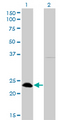 NFYB Antibody - Western Blot analysis of NFYB expression in transfected 293T cell line by NFYB monoclonal antibody (M01), clone 6H6.Lane 1: NFYB transfected lysate(22.8 KDa).Lane 2: Non-transfected lysate.