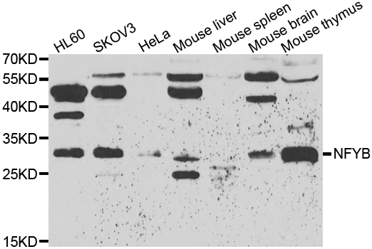 NFYB Antibody - Western blot analysis of extracts of various cell lines.