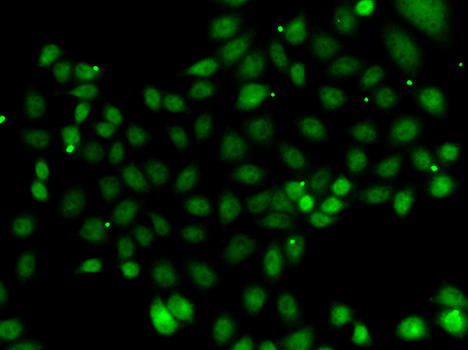 NFYB Antibody - Immunofluorescence analysis of MCF7 cells.