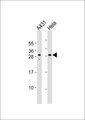 NFYB Antibody - All lanes: Anti-NFYB Antibody at 1:1000 dilution. Lane 1: A431 whole cell lysate. Lane 2: HeLa whole cell lysate Lysates/proteins at 20 ug per lane. Secondary Goat Anti-Rabbit IgG, (H+L), Peroxidase conjugated at 1:10000 dilution. Predicted band size: 23 kDa. Blocking/Dilution buffer: 5% NFDM/TBST.