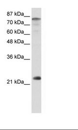NFYB Antibody - Transfected 293T Cell Lysate.  This image was taken for the unconjugated form of this product. Other forms have not been tested.
