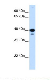 NFYC Antibody - Transfected 293T cell lysate. Antibody concentration: 0.25 ug/ml. Gel concentration: 12%.  This image was taken for the unconjugated form of this product. Other forms have not been tested.