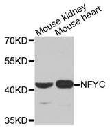 NFYC Antibody - Western blot analysis of extracts of various cells.