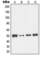 NFYC Antibody - Western blot analysis of NFYC expression in K562 (A); NIH3T3 (B); HeLa (C); Jurkat (D) whole cell lysates.