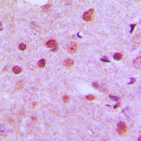 NFYC Antibody - Immunohistochemical analysis of NFYC staining in human brain formalin fixed paraffin embedded tissue section. The section was pre-treated using heat mediated antigen retrieval with sodium citrate buffer (pH 6.0). The section was then incubated with the antibody at room temperature and detected using an HRP conjugated compact polymer system. DAB was used as the chromogen. The section was then counterstained with hematoxylin and mounted with DPX.